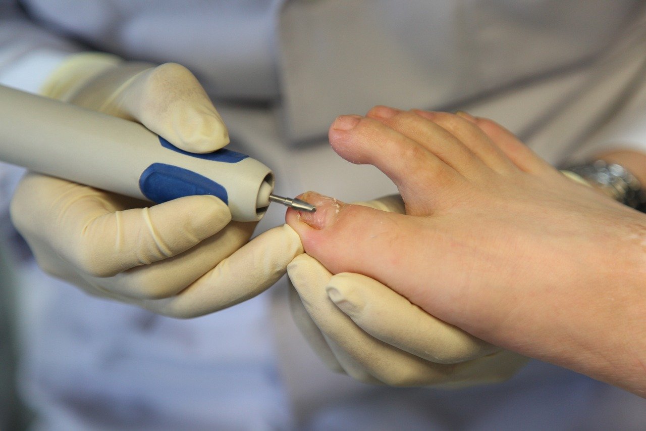 toenail, foot care, foot, nail care, toes, hygiene, hand tool, podiatrist, closeup, toenail, toenail, toenail, foot care, foot care, foot care, podiatrist, podiatrist, podiatrist, podiatrist, podiatrist